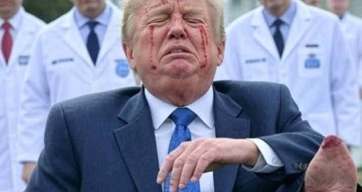 ⭐⭐BREAKING: President Donald Trump Falls, Breaks Ankle While Leaving the White House—Rushed to Hospital. “THE PRESIDENT IS SAID TO BE IN CRITICAL PAINS”….See More