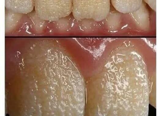 🚨🚨Be careful!! This is what your teeth will become when you eat…
