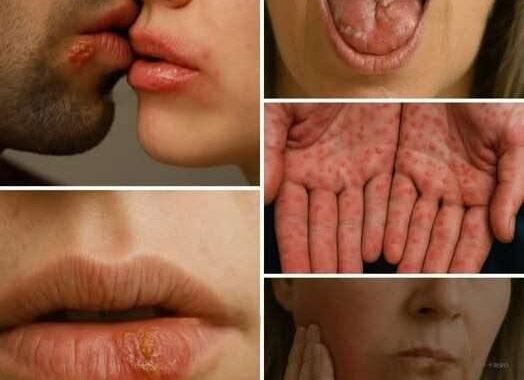 Don’t Underestimate It: Recognizing the Early Signs of Oral Can…