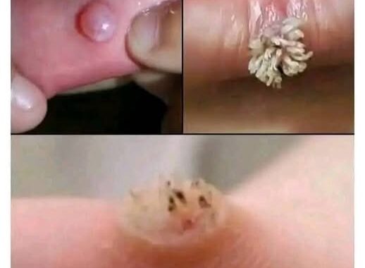 BE VERY CAREFUL 🤧🤧 . If you get this, you are infected with …. See more