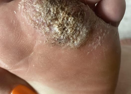 BE VERY CAREFUL 🚨. If you get this, you are infected with …. See more