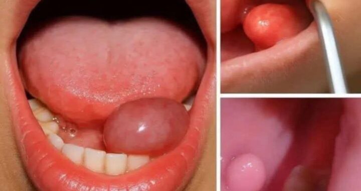 These are the first symptoms of a…See more