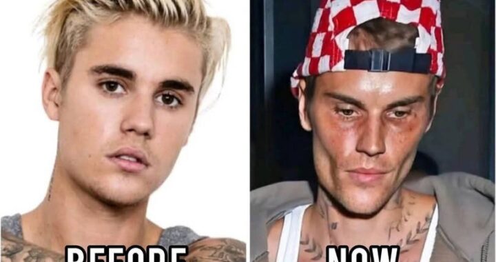 🥺Justin Bieber admits that he tested positive for…See more