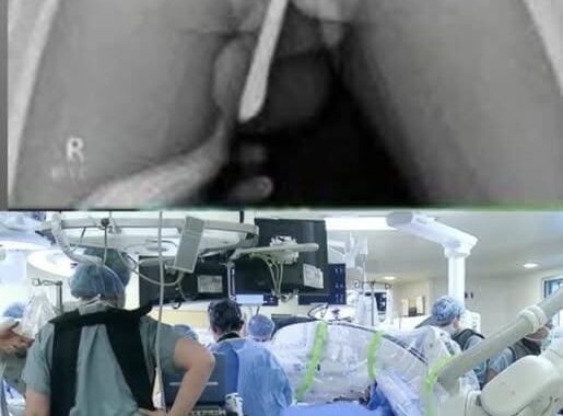 😱😱😢Girl had to be hospitalized for wanting to use a pe…See more