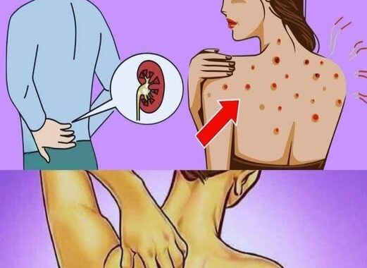 😳😳Warning Signs Your Kidneys Are in Danger – What to Watch For